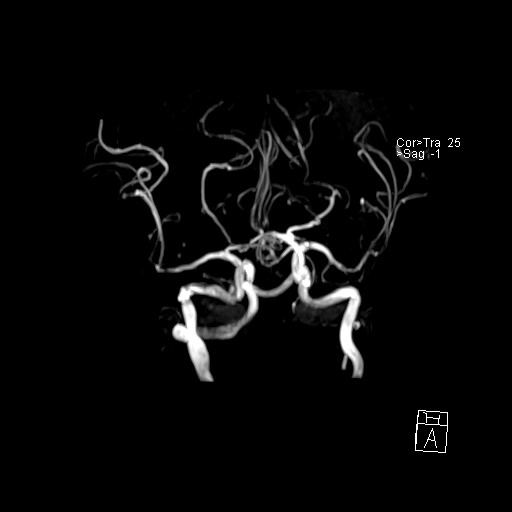 Click on the Serie image to view the images of VILLANUEVA, WILLIAM A.